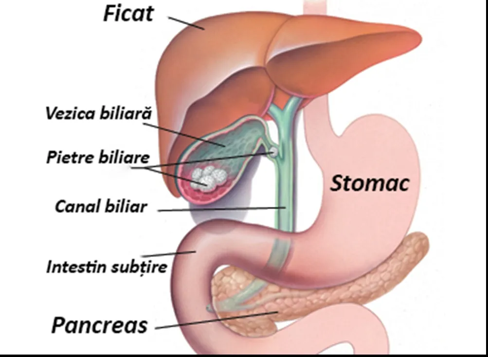 Cancerul vezicii biliare: primele simptome