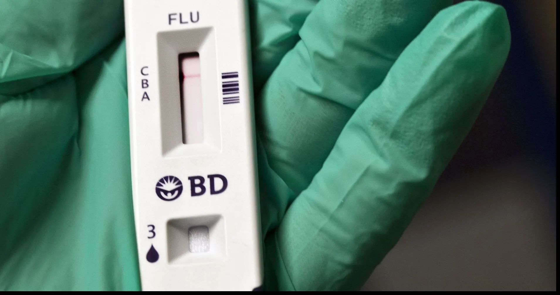 Spitalul de Boli Infecţionase Craiova nu are teste rapide de depistare a gripei