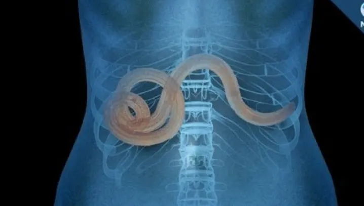 Semne clare că ai paraziți în organism