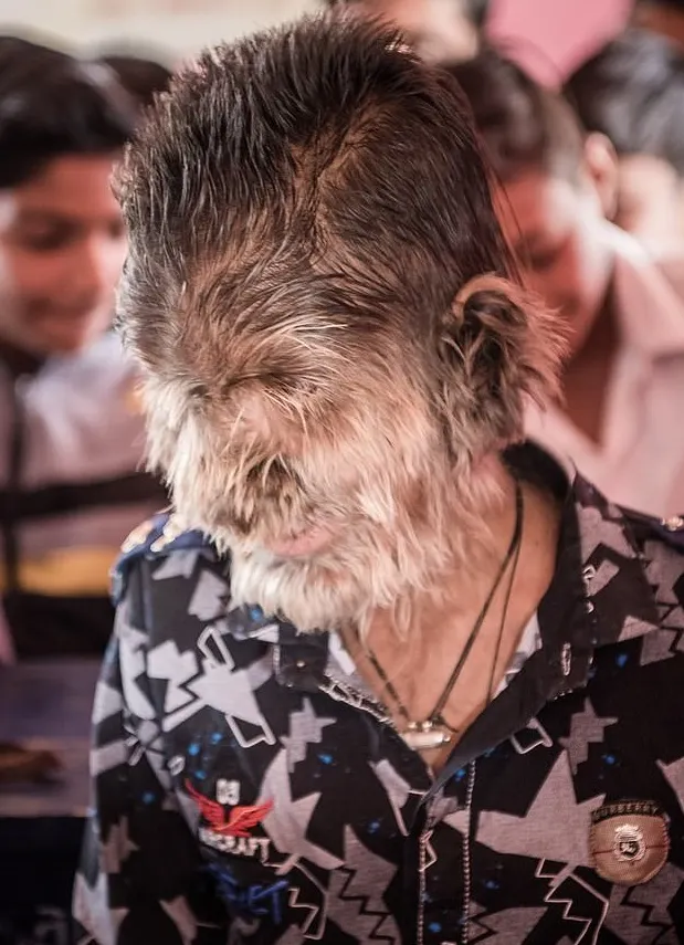 Copilul vârcolac șochează lumea. Părinții și-au dorit un băiat, dar au avut 5 fete. Apoi...