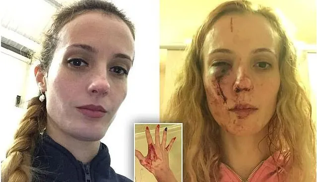 O tânără mamă din România, victima unui atac rasist în UK: M-au lovit cu pumnii și genunchii în față