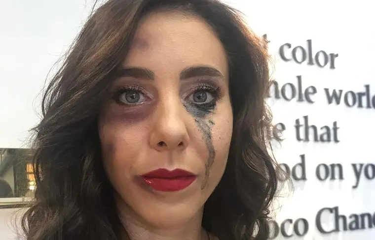 Miki Buzărnescu, imagine disperată: vânătă şi cu ochii în lacrimi