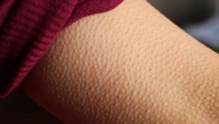 Ce înseamnă dacă ți se face ”pielea de găină” atunci când asculți muzică. Nu îți va veni să crezi