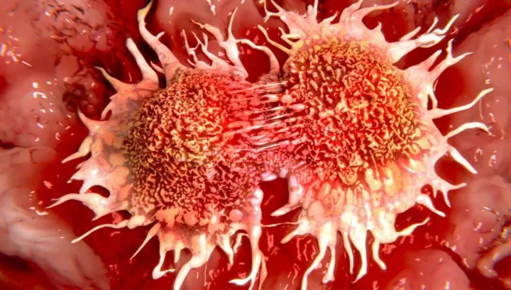 Ce ai în casă și te îmbolnăvește de CANCER. Trebuie să iei măsuri imediat! 