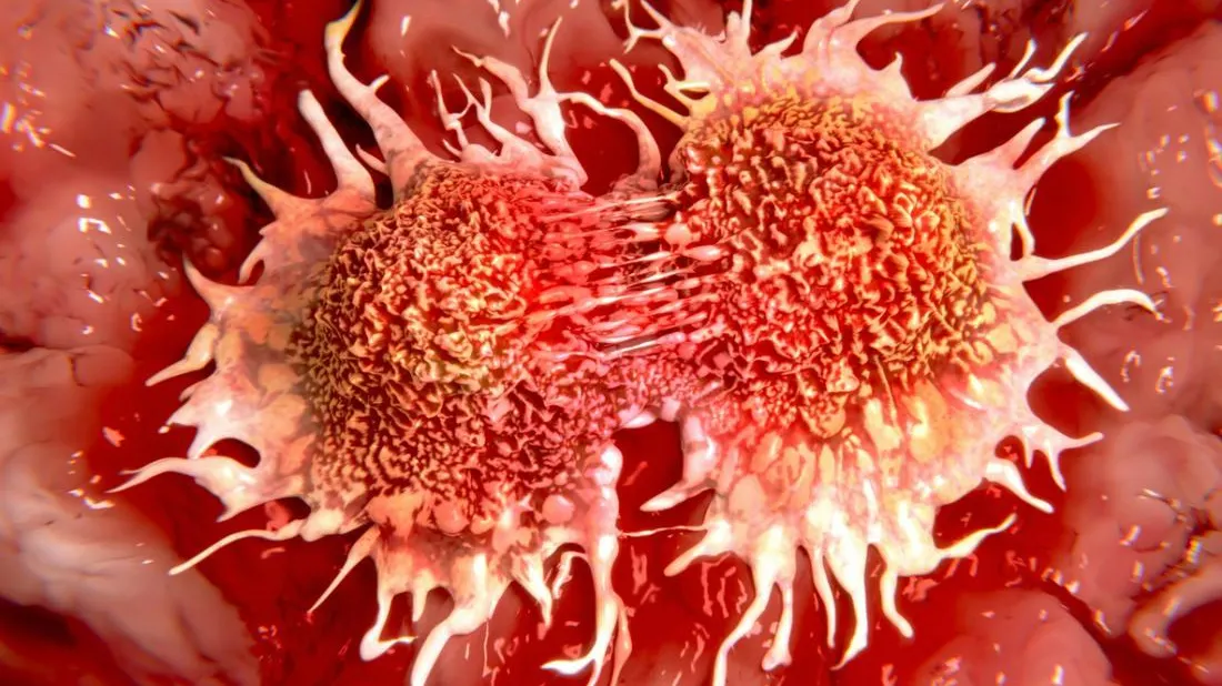 Ce ai în casă și te îmbolnăvește de CANCER. Trebuie să arunci chiar acum! 
