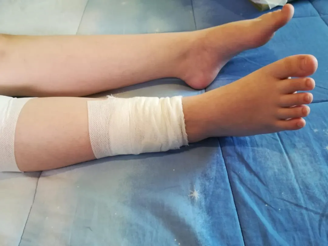 Caz șocant în Sibiu: Fetiță de 10 ani sfâșiată de un câine maidanez. FOTO