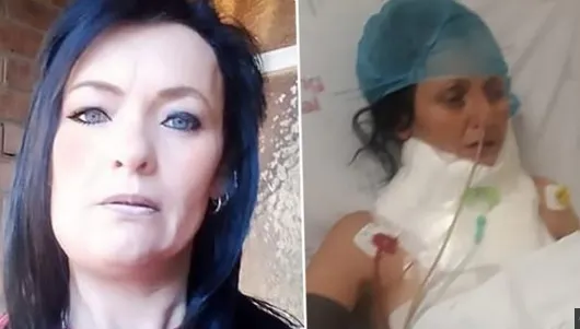 Credea că are o carie. La dentist, a venit șocul: înăuntru era un gândac care-i devora carnea