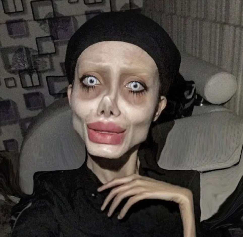 Femeia care s-a operat să semene cu Angelina Jolie a fost arestată