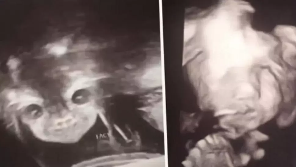 La ecografie, a primit șocul: "E copilul diavolului! Mi se uită direct în suflet!" Ce purta în pântec
