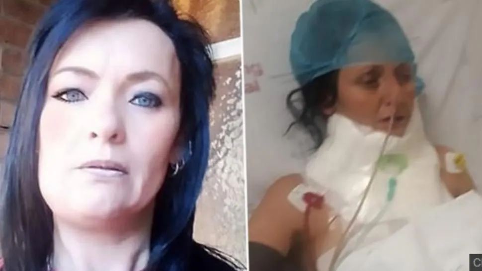 Credea că are o carie. La dentist, a urmat șocul: înăuntru era un gândac care-i devora carnea