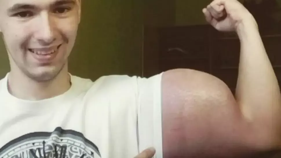 Băiatul cu braţele cât Popeye şochează din nou! Cum arată iubita lui. Imagini tulburătoare
