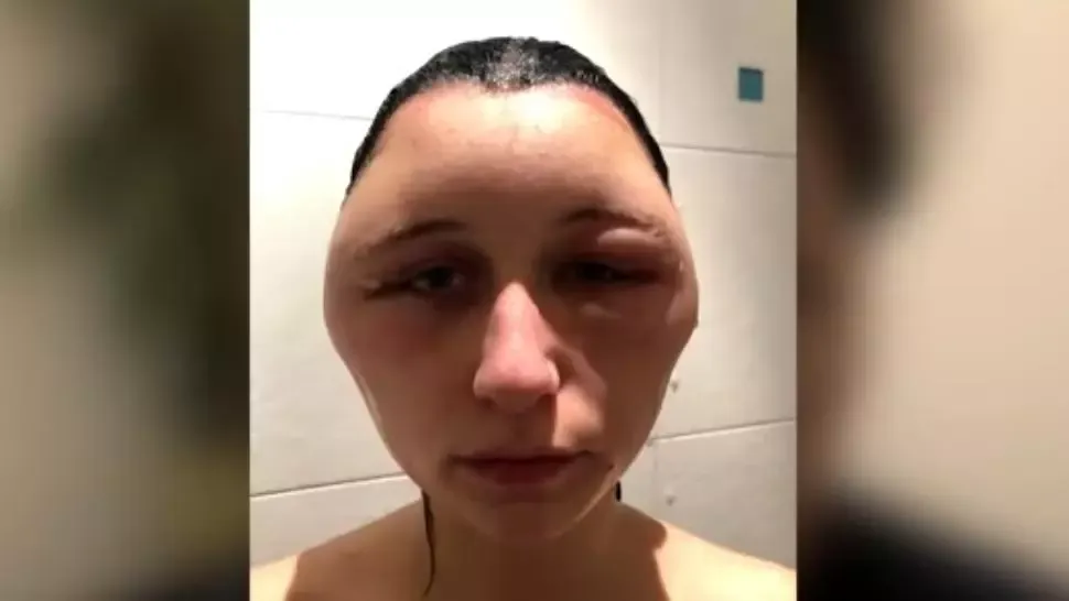 Aproape moartă, din cauza unei greşeli pe care şi tu o faci. Ce a desfigurat-o i-a şocat pe medici!