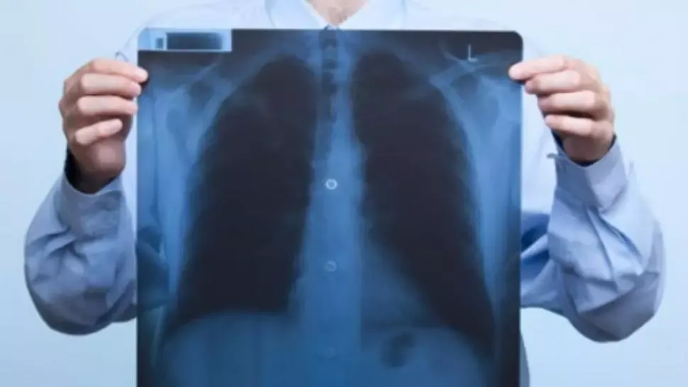Dacă fumezi, mănâncă asta de două ori pe săptămână ca să reduci la jumătate riscul de cancer