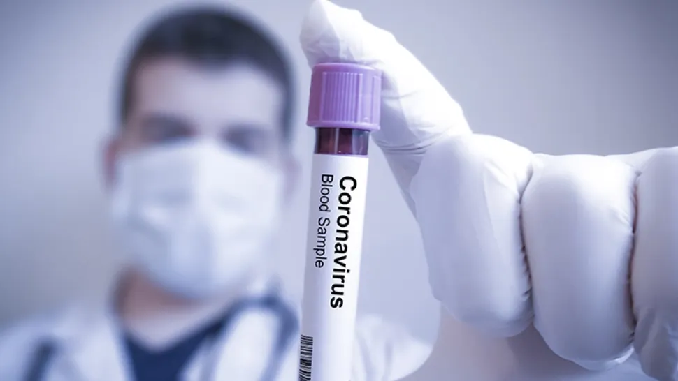 Indicele de infectare în România