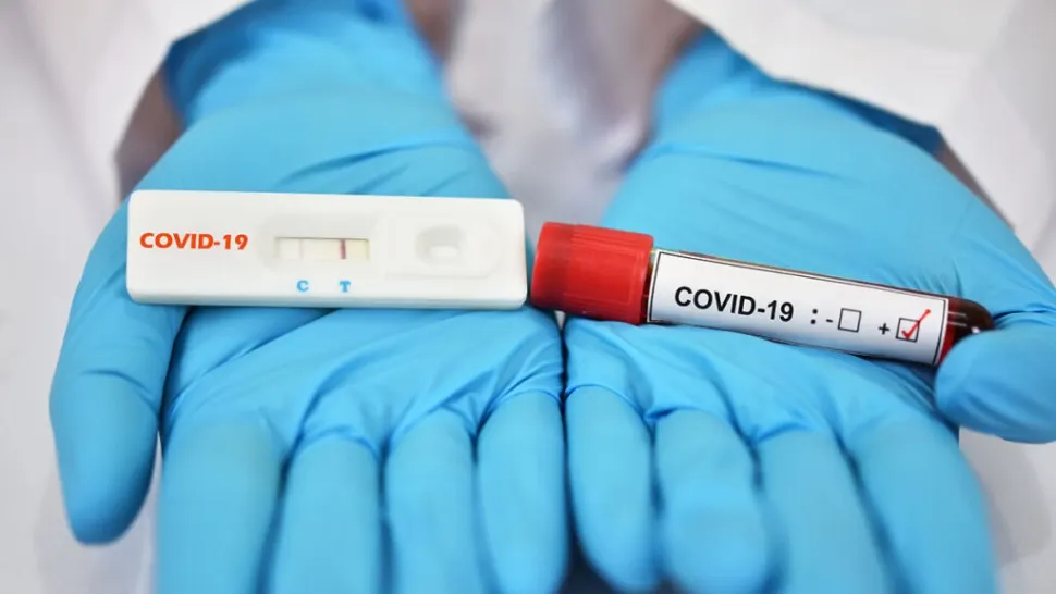 Teste covid antigen românești