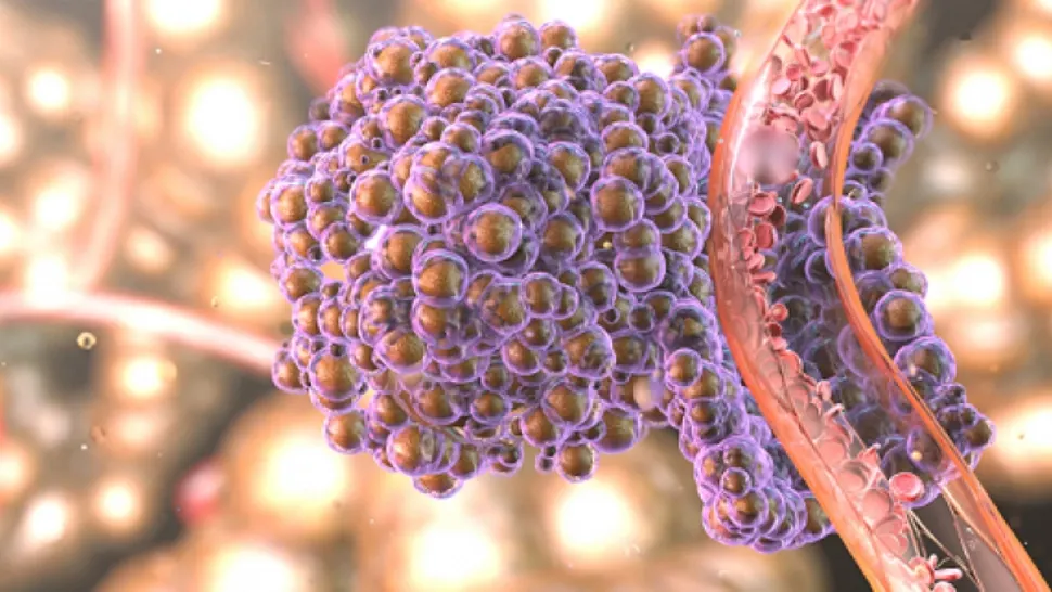 Băutura simplă care distruge cancerul