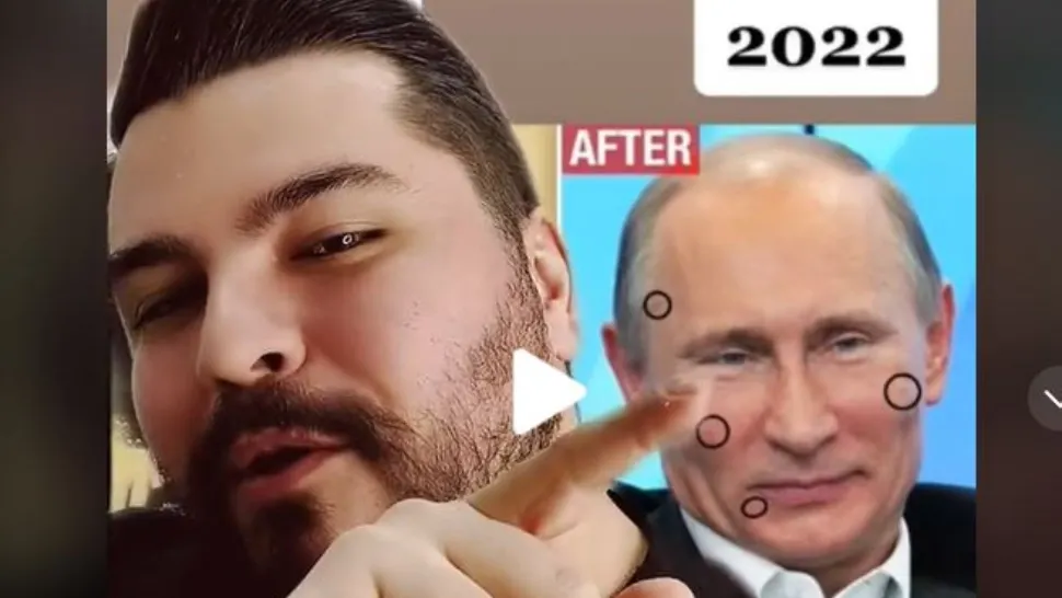 Operatiile estetice ale lui Putin