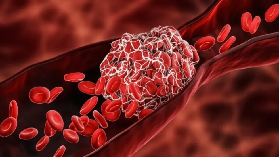 Cele mai importante vitamine pentru un sânge sănătos - Remediile simple care întăresc inima și au efect anticoagulant