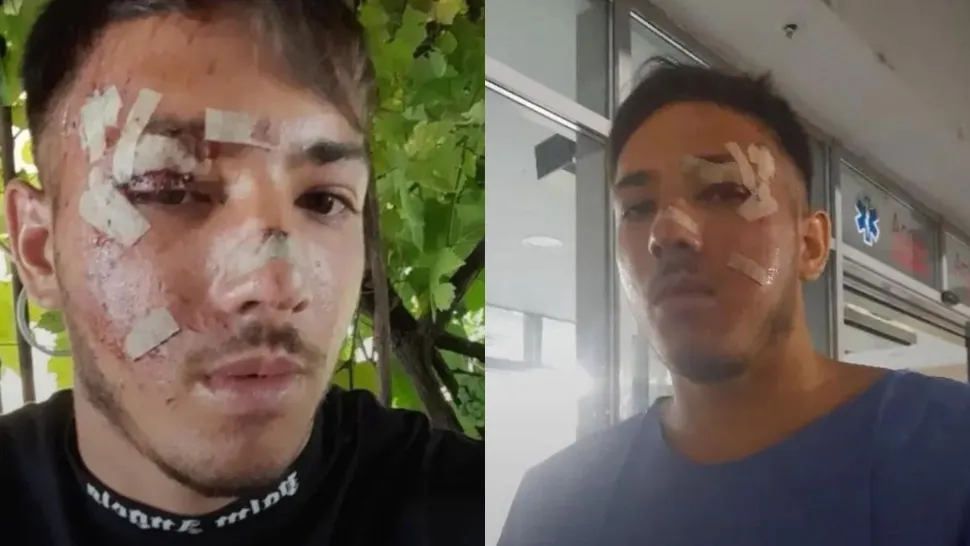 Marian a scăpat ca prin minune în urma unui accident rutier mortal. Duba în care se afla s-a făcut praf după ce a intrat în coliziune cu o autoutilitară - VIDEO