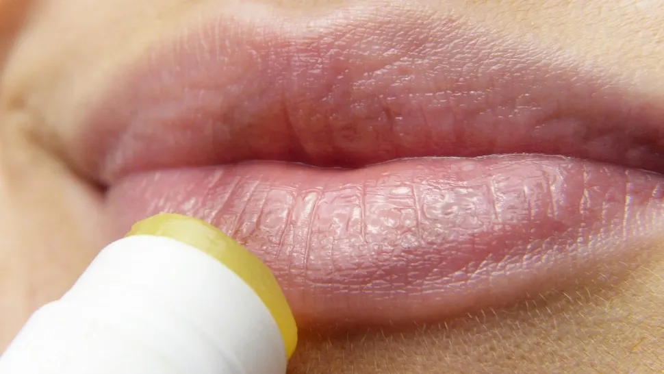 Cum să scapi rapid de herpes. Ce trebuie să știi ca să eviți apariția acestei afecțiuni inestetice 