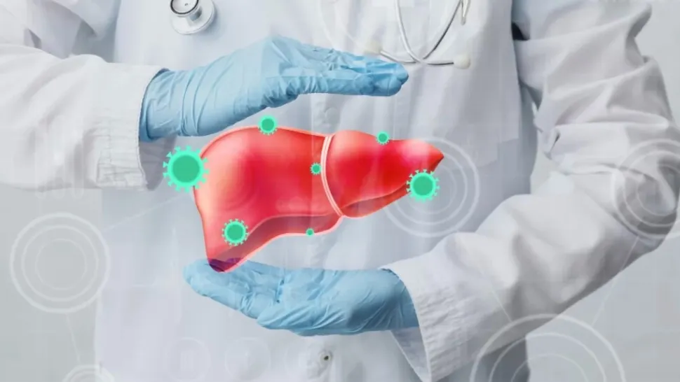 Chist hepatic