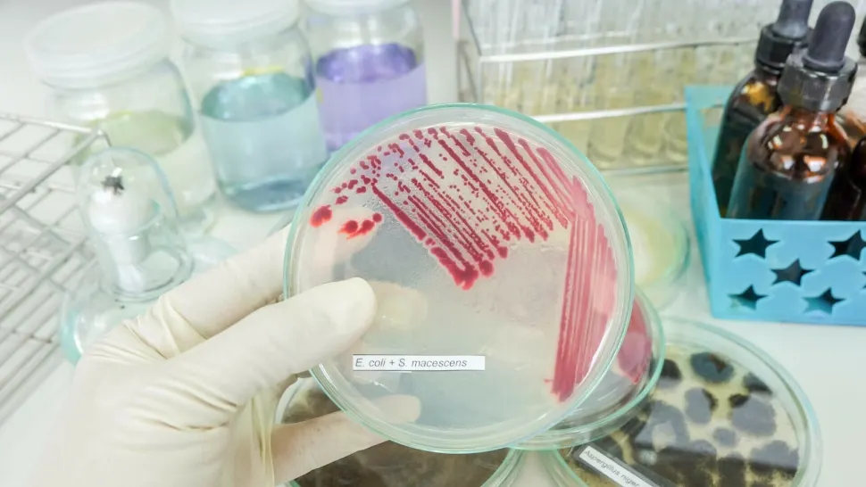 Cum putem preveni infecțiile nosocomiale și salva viețile copiilor: lecții după tragedia de la Iași (P)