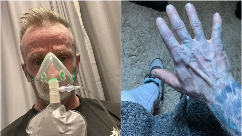 Un bărbat a ajuns la spital după ce s-a trezit complet albastru. Explicația i-a făcut pe medici să râdă