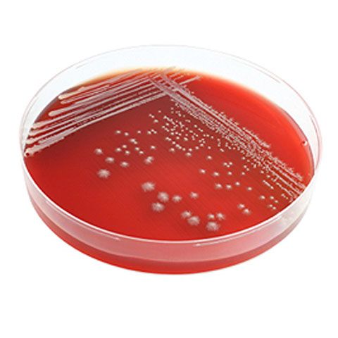 Top 10 descoperiri ştiinţifice accidentale