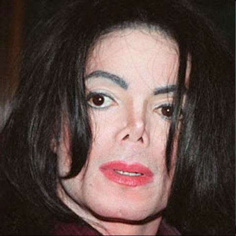 Michael Jackson rămâne fără piele