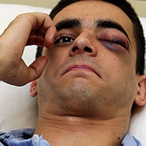 Zarko Sesum a fost externat din spital, iar Ivan Pesici are nevoie de transplant 