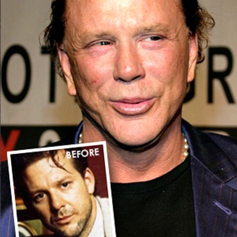 Ce s-a întâmplat cu faţa lui Mickey Rourke? 