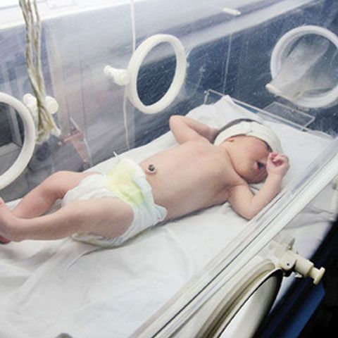 Doctorii au rupt intenţionat mâna unui bebeluş, la naştere 