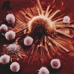 "Glonţul magic" ar putea înlesni tratamentul cancerului