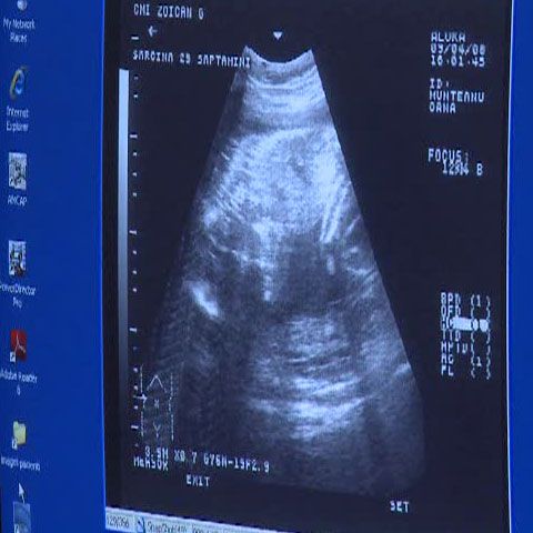 Doi tineri din Bacău susţin că fetiţei lor i-a fost ruptă clavicula la naştere 