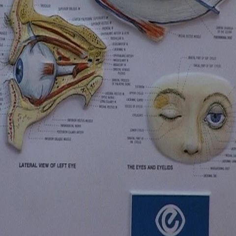 O tânără care a avut cataractă, vede pentru prima dată în 18 ani