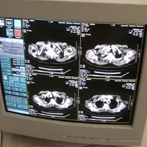 La Spitalul Judeţean de Urgenţă Ploieşti au loc des pene de curent 
