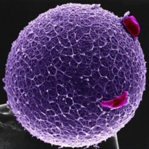 Donatoarele de ovule din România primeau între 800 şi 1.000 de lei, potrivit DIICOT