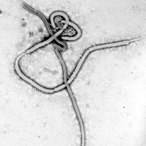 Un nou virus foarte periculos, comparabil cu Ebola, a fost descoperit în Africa
