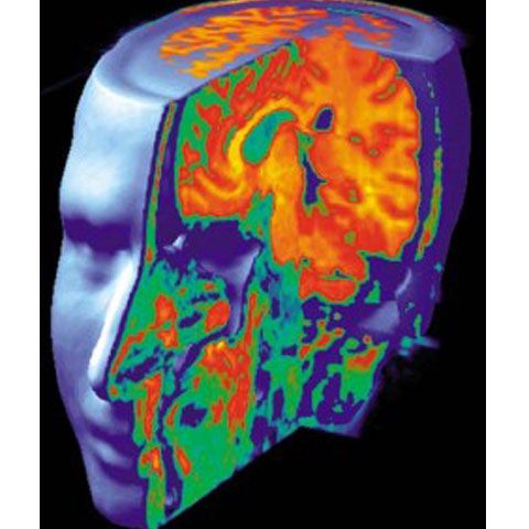 Patru americani dotaţi cu o memorie ieşită din comun sunt prezentaţi de Mental Floss Magazine