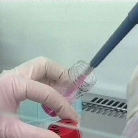 Programul naţional de depistare a cancerului de col uterin a fost demarat