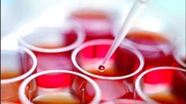Inovaţie în chirurgia estetică: Sâni măriţi cu celule stem