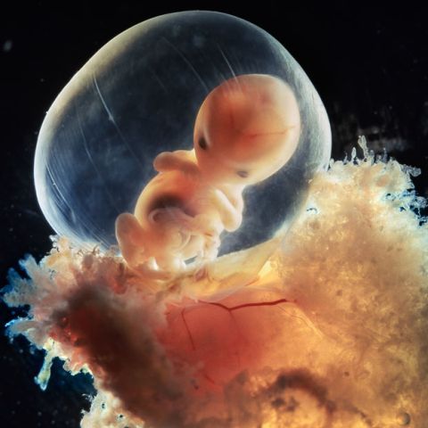 Fotografii incredibile: dezvoltarea unui fetus în uter - VEZI GALERIE