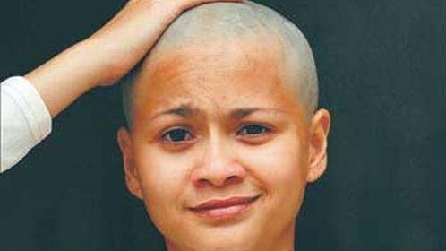 Curele de slăbire duc la căderea părului 