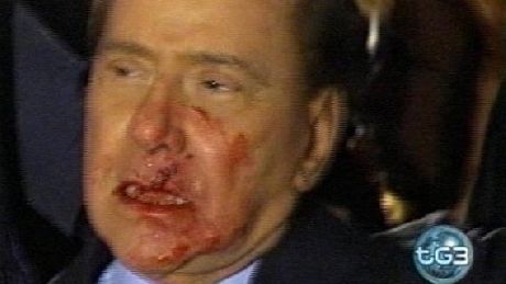 Bărbatul care l-a lovit pe Berlusconi şi-a cerut scuze 