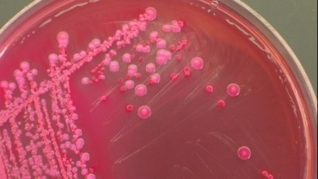 Ce este bacteria E.coli: cum se transmite şi cum poate fi prevenită infecţia. Primele simptome