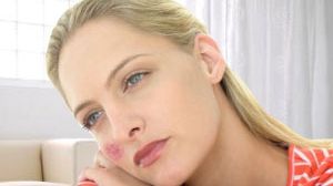 Ai aceste simptome? Mergi de urgenţă la medic! Este LUPUS