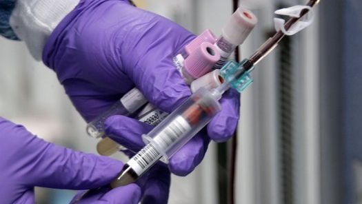 Un test de sânge va depista Alzheimerul