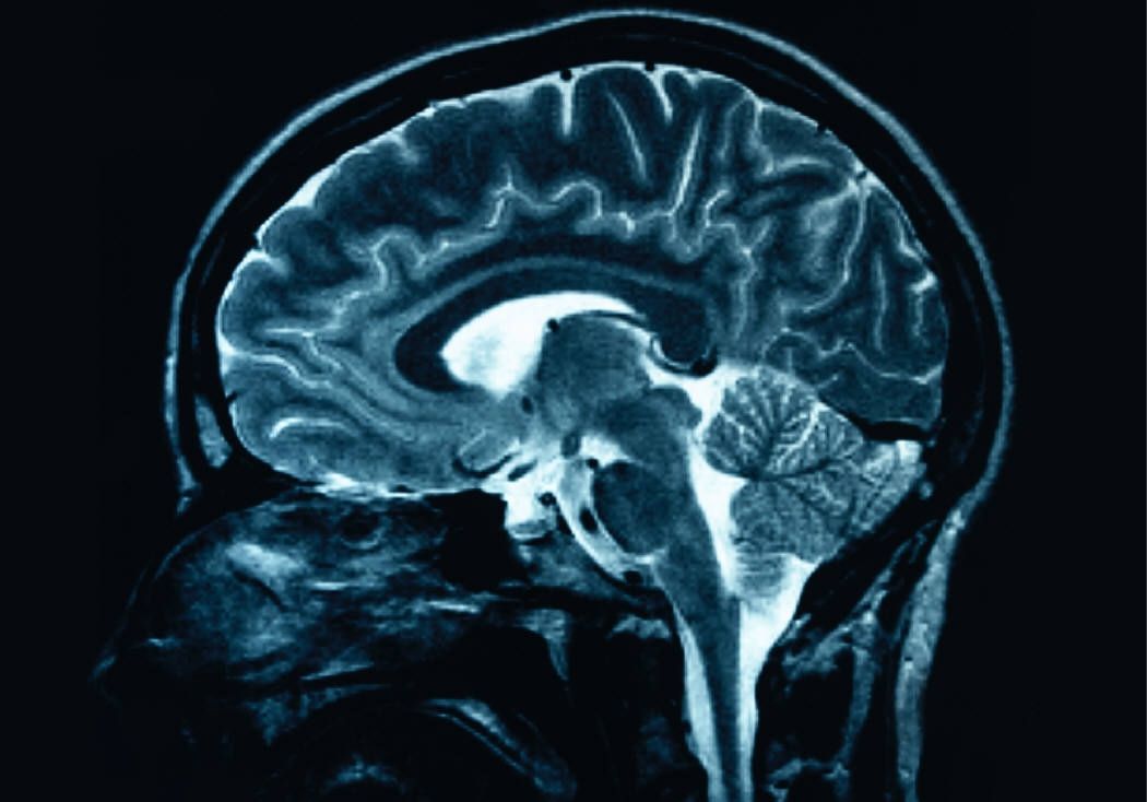 A fost diagnosticat cu tumoare la creier, mai avea puţin de trăit. Ce a urmat i-a lăsat pe toţi muţi