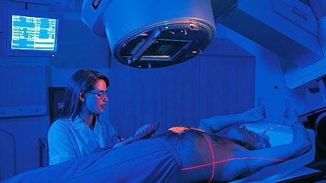 Radioterapia externa