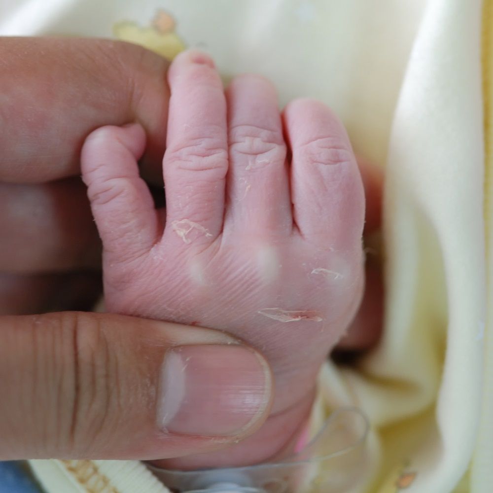 Naşterile prin cezariană nu vor mai fi decontate de stat 